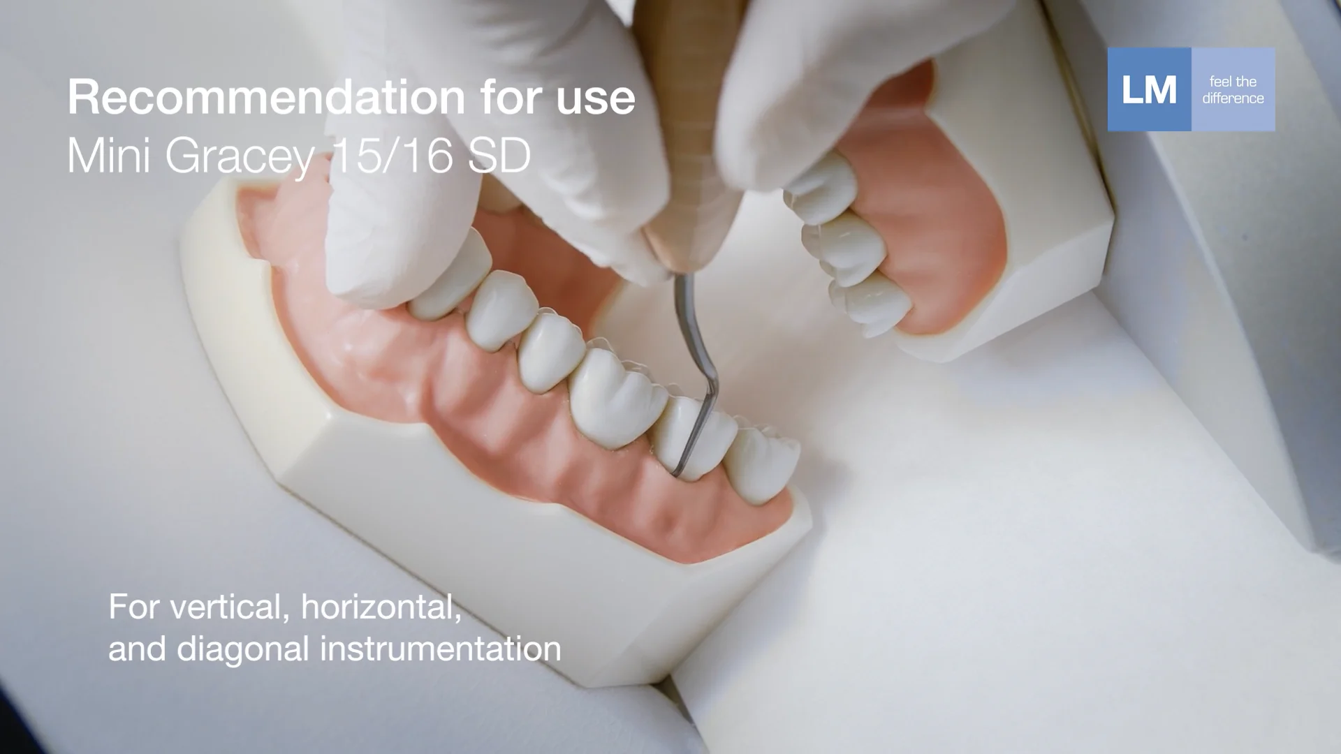 How to use Mini Gracey 15-16 SD LM™ hand instruments on Vimeo
