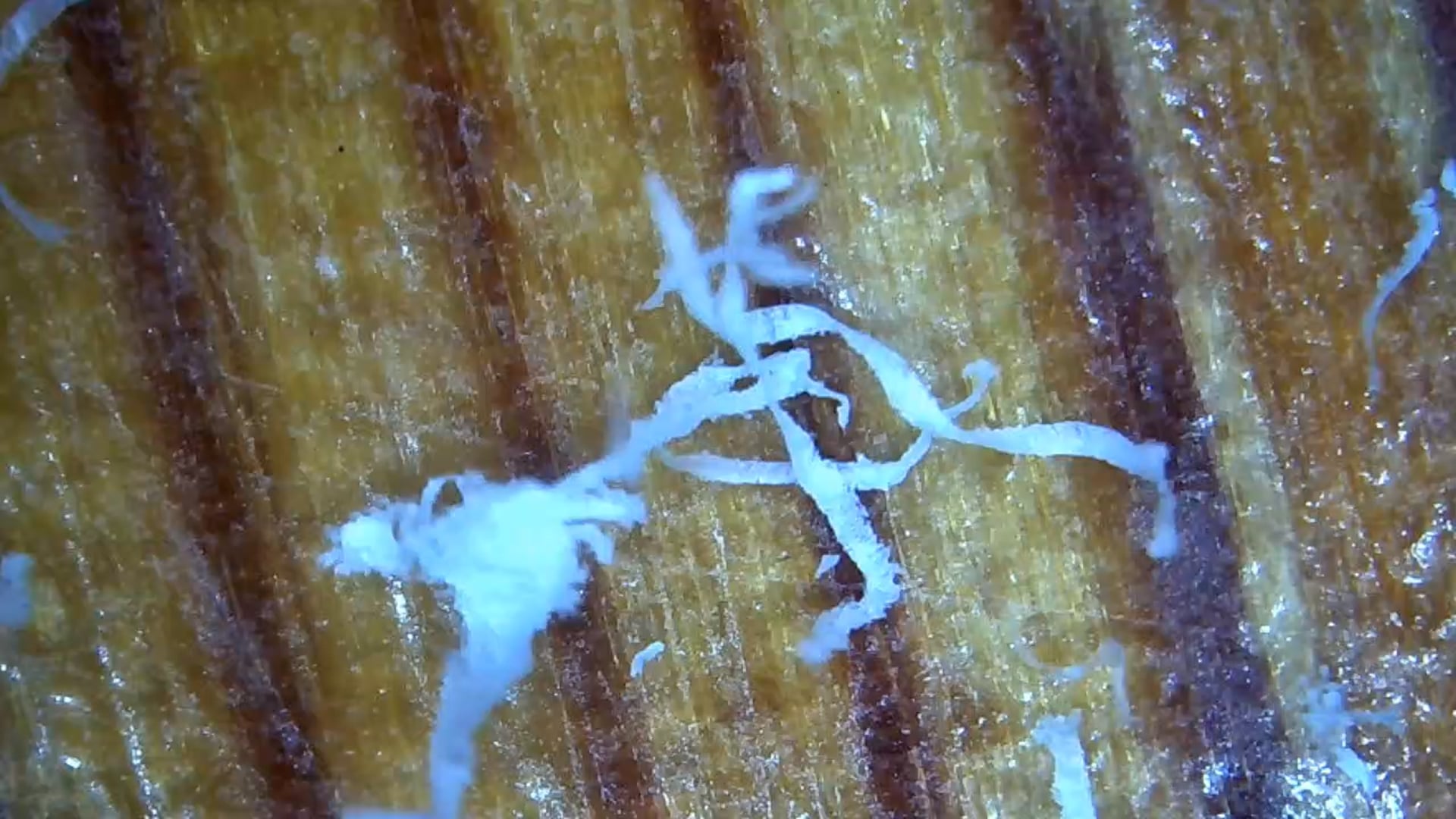 Finger Nail Polymer Scrapings