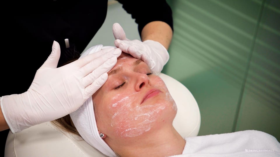 Video afspelen "Promotiefilm | Skinceuticals - Huidverkleuring behandeling (2021)"