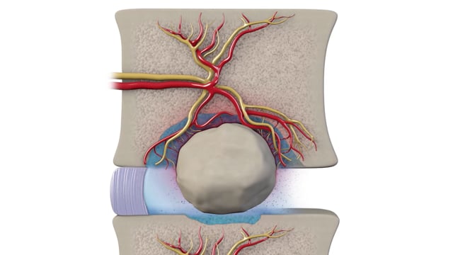 Medical Legal Spine Injury