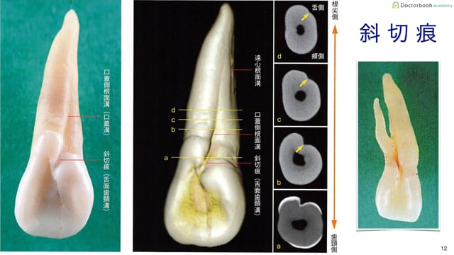 いまさら聞けない歯牙解剖 | Doctorbook academy (ドクターブックアカデミー)