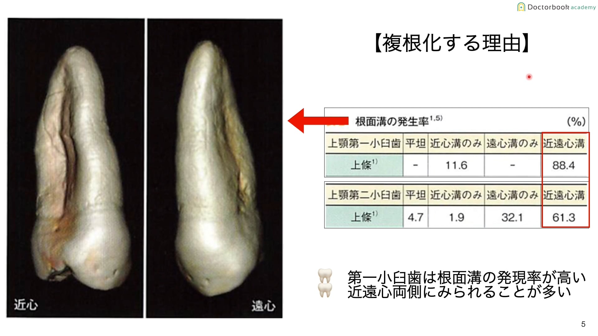 小臼歯編 Part1