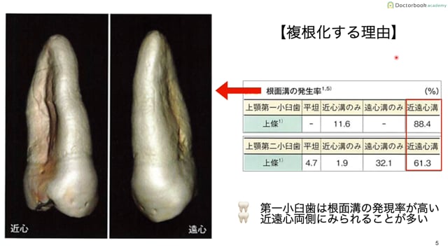 小臼歯編 Part1