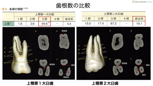 大臼歯編 Part1