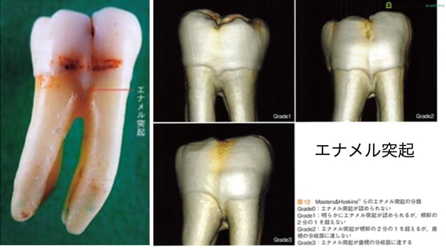 いまさら聞けない歯牙解剖 | Doctorbook academy (ドクターブック