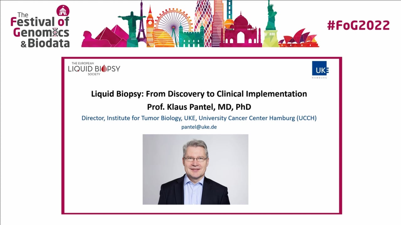 Liquid biopsy: From discovery to clinical implementation