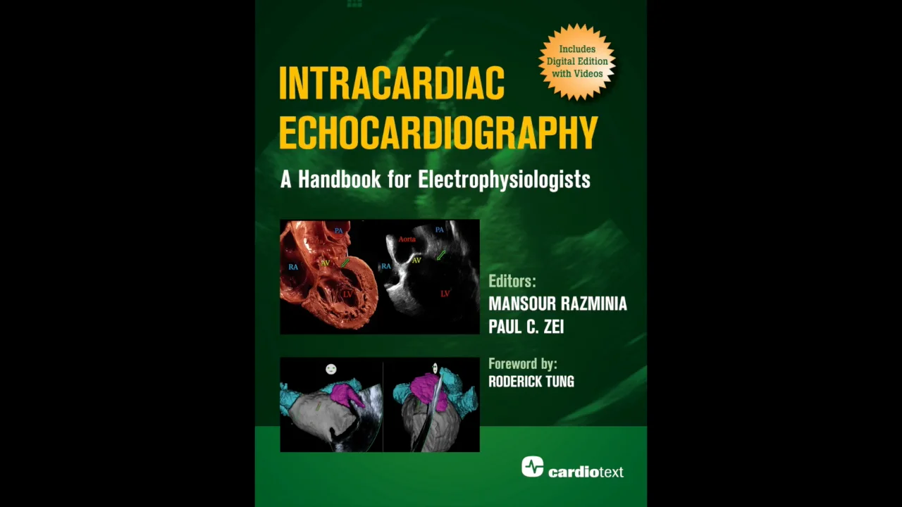 Intracardiac Echocardiography: A Handbook for Intracardiac Echocardiography: A Handbook for