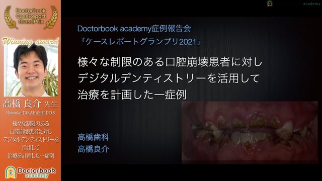 【第5回 ケースレポートGP全顎治療セッション 上位入賞】No.3 高橋良介先生「様々な制限のある口腔崩壊患者に対しデジタルデンティストリーを活用して治療を計画した一症例」