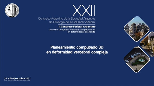 "Planeamiento computado 3D en deformidad vertebral compleja". Dr. Mariano Noel