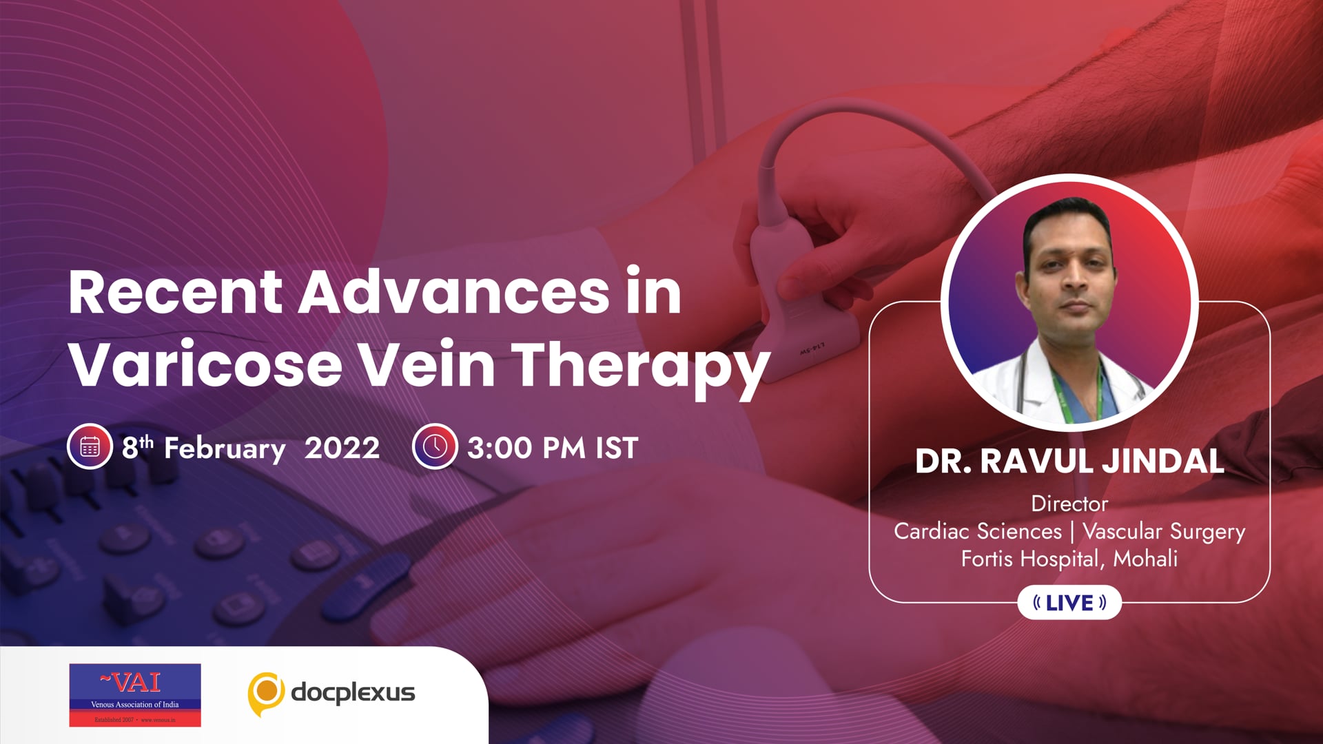 Recent Advances in Varicose Vein Therapy