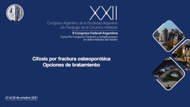"Cifosis por fractura osteoporótica. Opciones de tratamiento" Dr. Marcelo Amaro