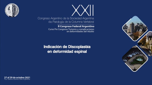 "Indicación de Discoplastía en Deformidad Espinal". Dr. Marcelo Gruenberg