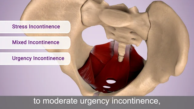 Urinary incontinence: Video, Anatomy & Definition