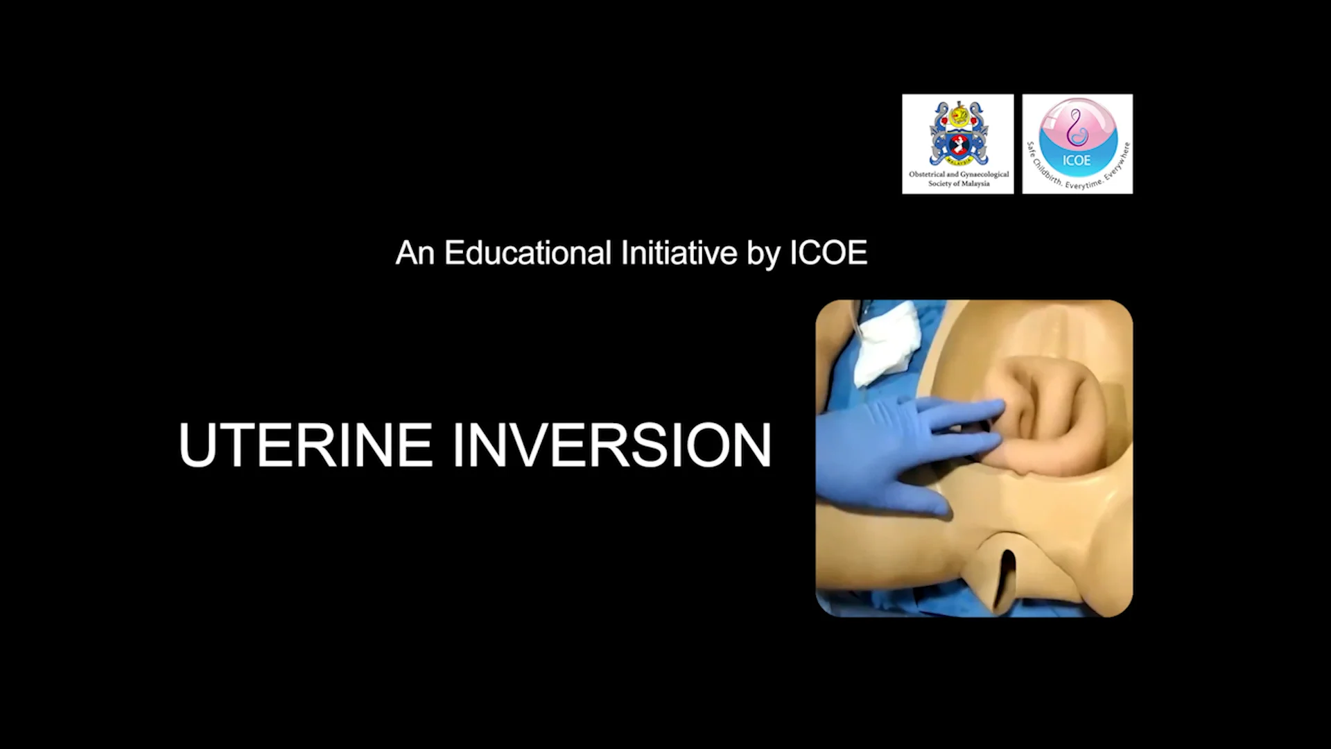 Uterine Inversion