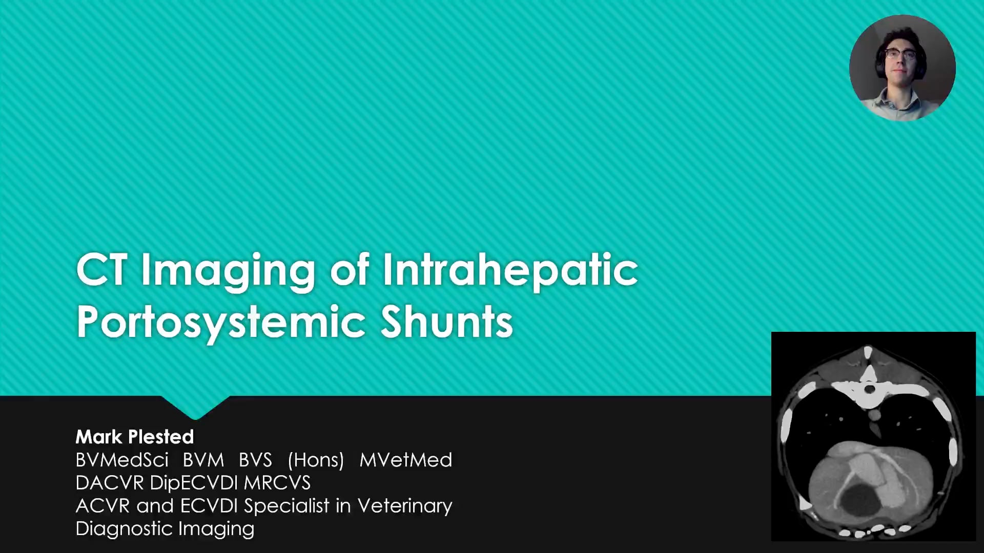 CT imaging of intrahepatic portosystemic shunts