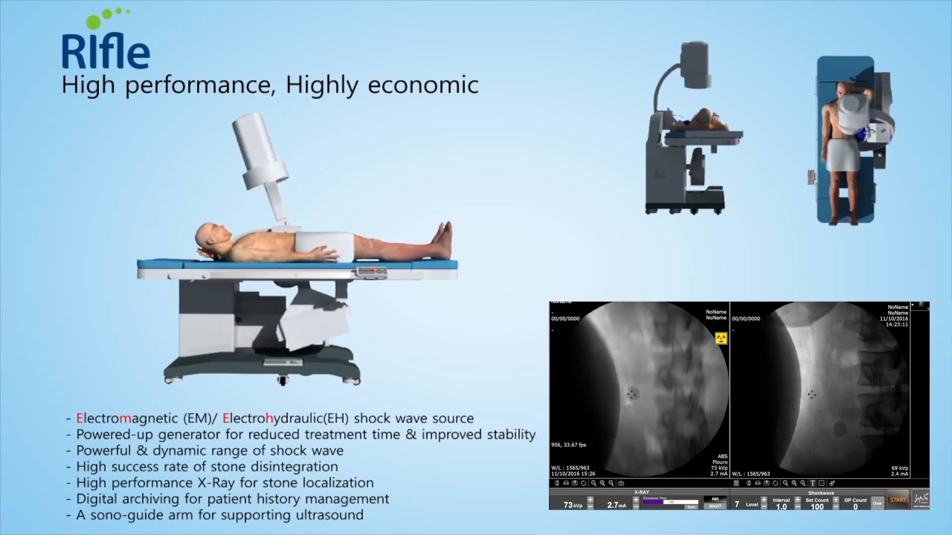 HNT
초음파 홍보영상