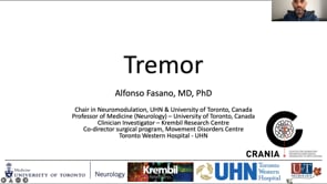 2: Tremor