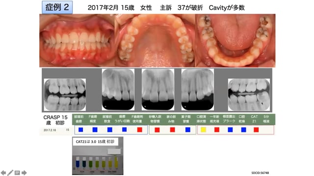 #3 カリスタット法の説明とCRASPを用いた症例