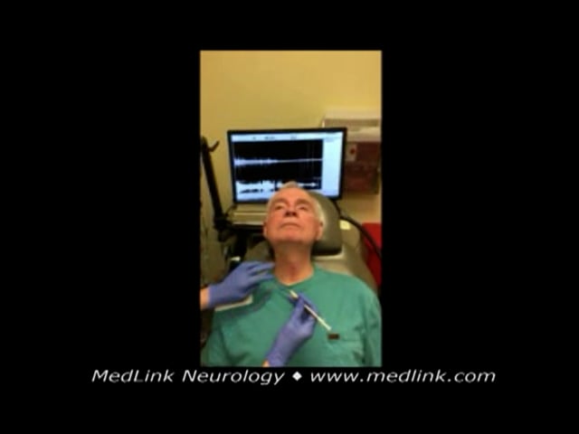 Adductor spasmodic dysphonia voice at baseline