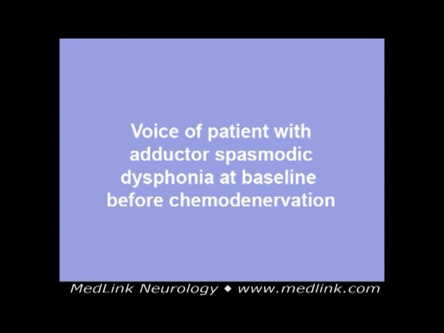 Chronic constriction variant of adductor spasmodic