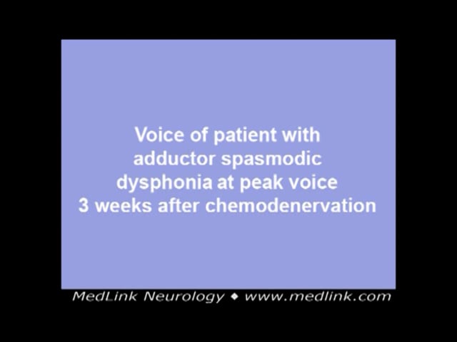 Chronic constriction variant of adductor spasmodic