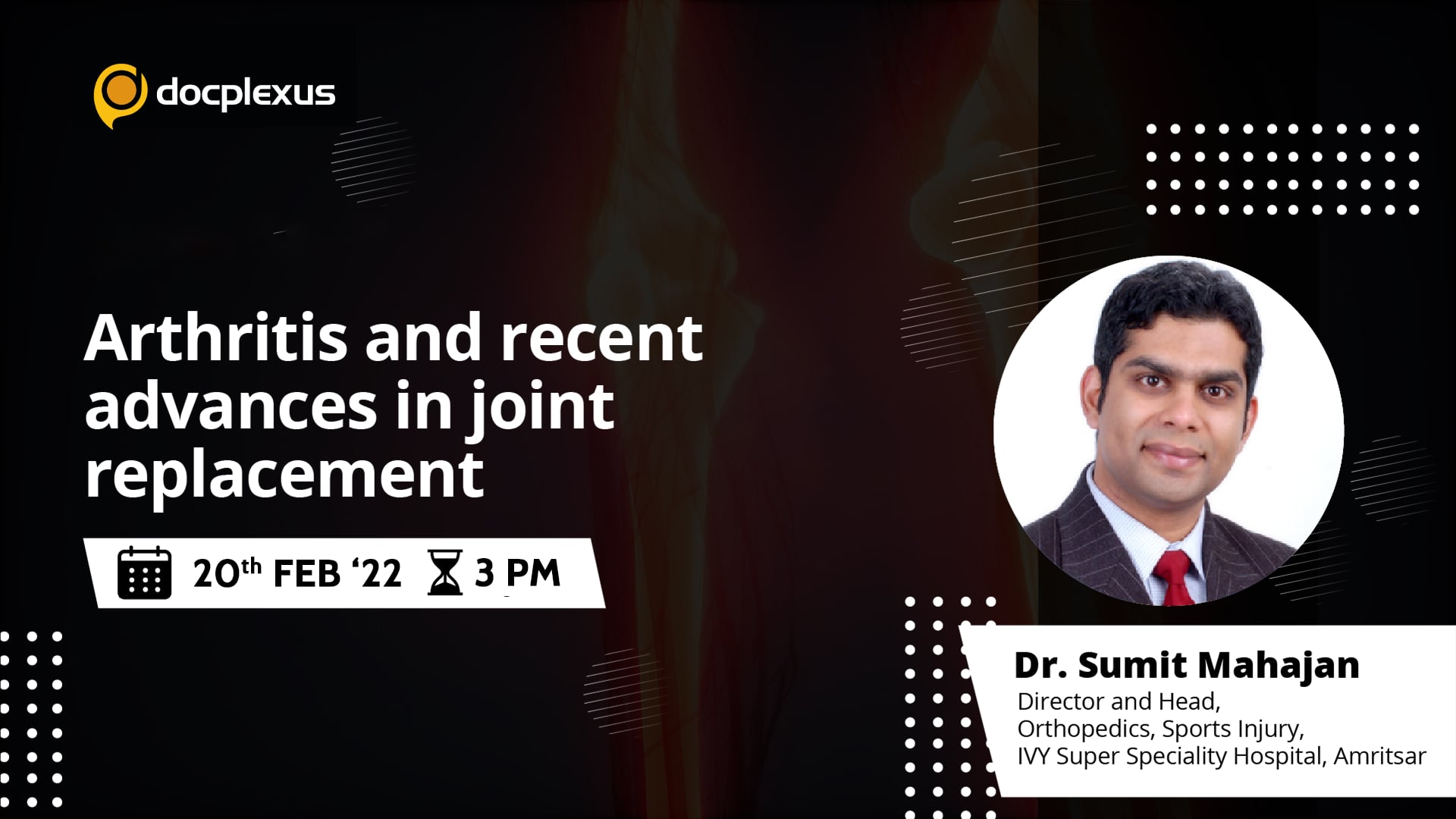 Arthritis and Recent Advances in Joint Replacement