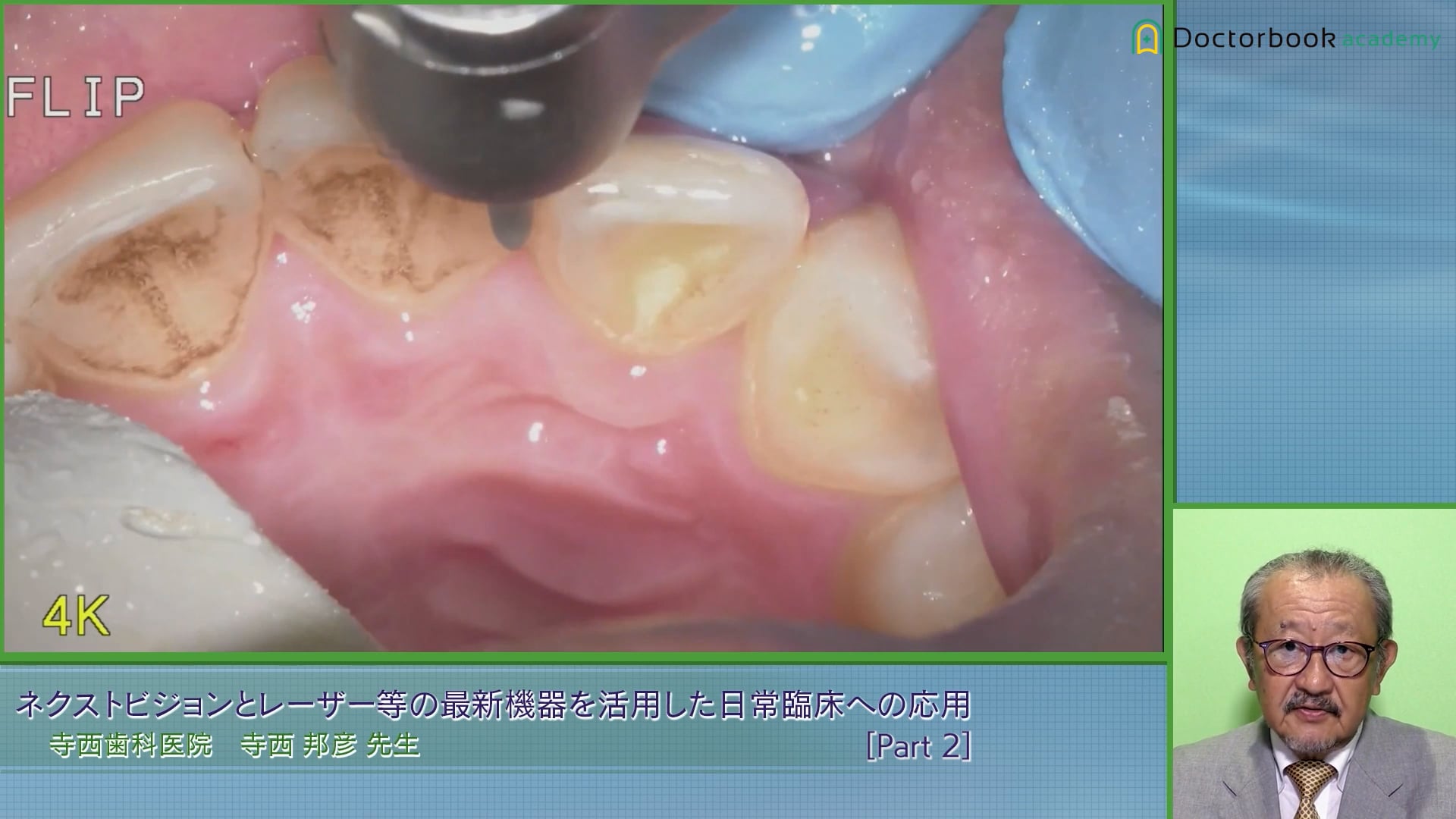 ネクストビジョンとレーザー等の最新機器を活用した 日常臨床への応用 Part2