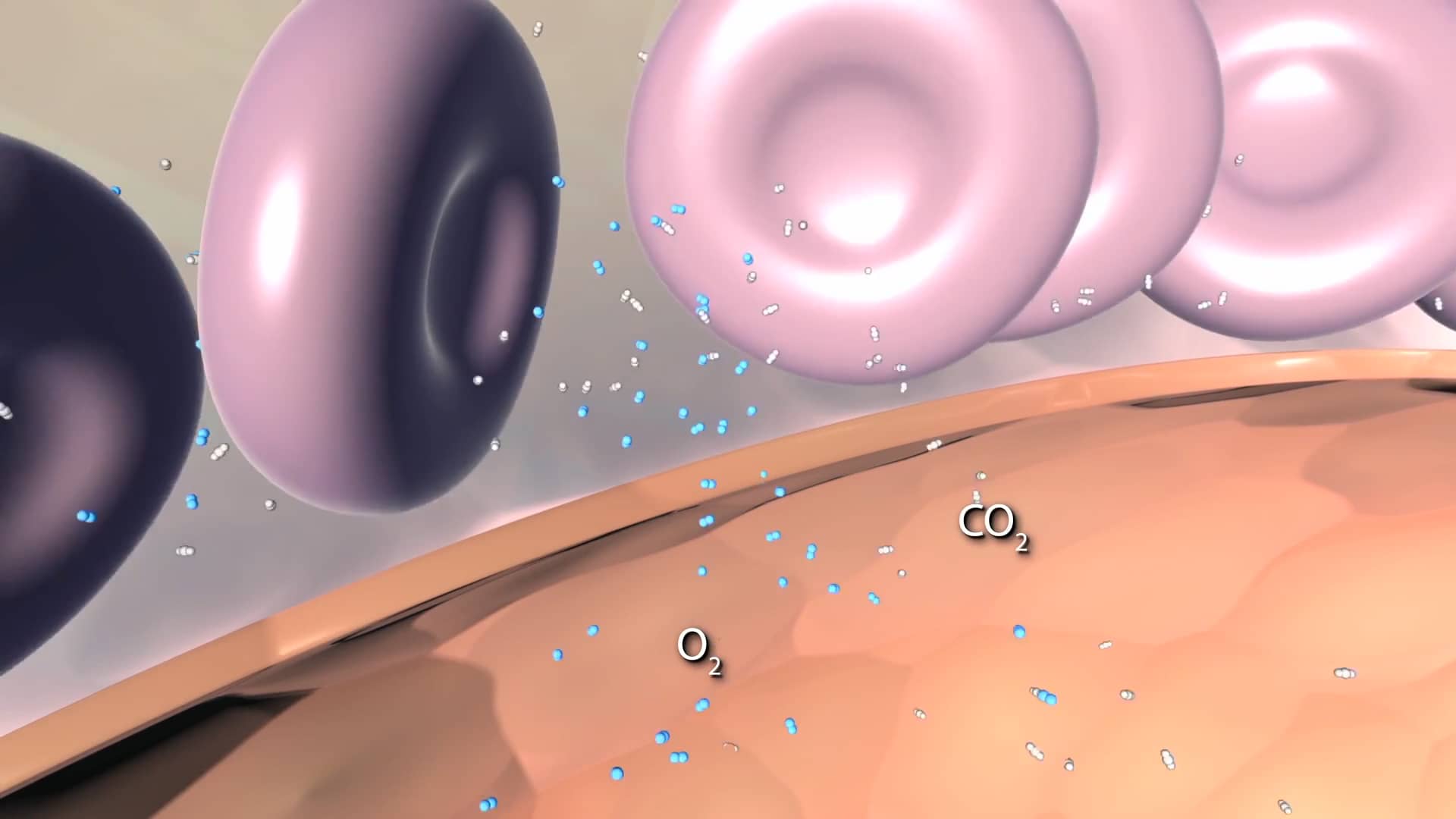 what-is-respiratory-failure-on-vimeo