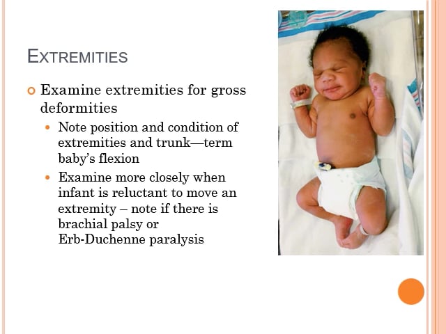 Newborn Assessment part 4 Extremities, neuro, reflexes redo on Vimeo