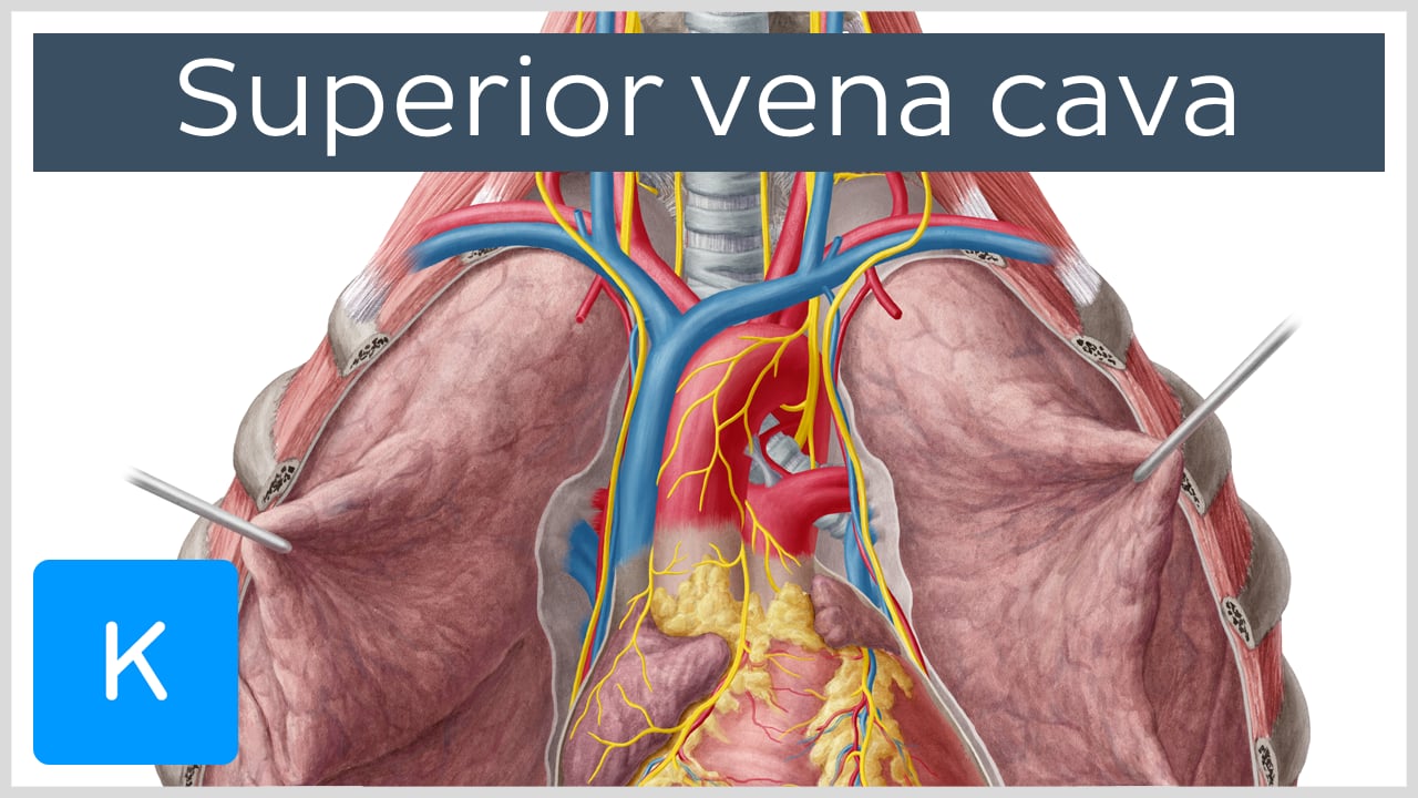 inferior vena cava syndrome