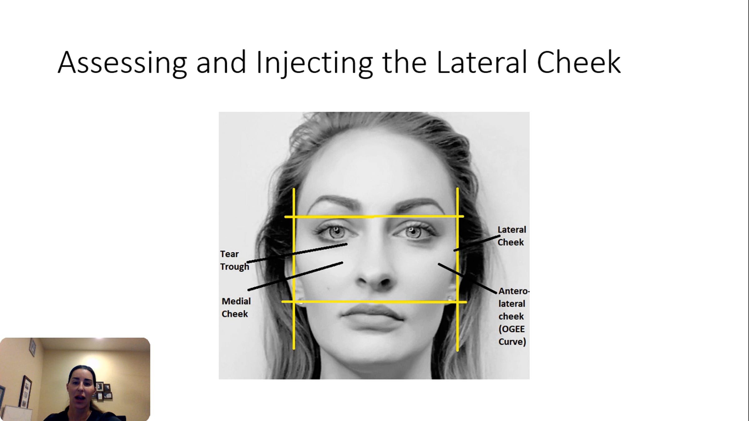 Lateral and Anterolateral Cheek Injection TEcnique.mp4 | Videos ...