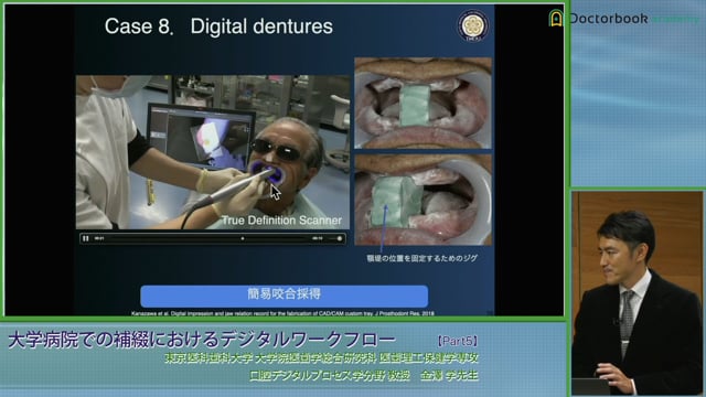 #5 デジタルデンチャー症例・歯科技工のデジタル化
