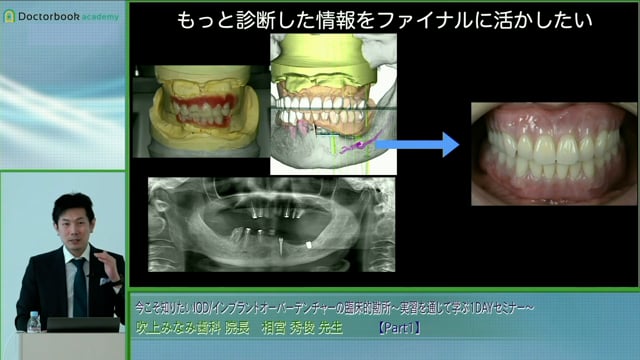 #1 今こそ知りたいIOD/インプラントオーバーデンチャーの臨床的勘所～実習を通じて学ぶ1DAYセミナー～【講義編】