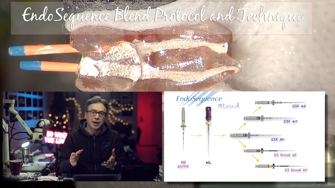 EndoSequence Blend Protocol Real World Endo Endodontics Educational