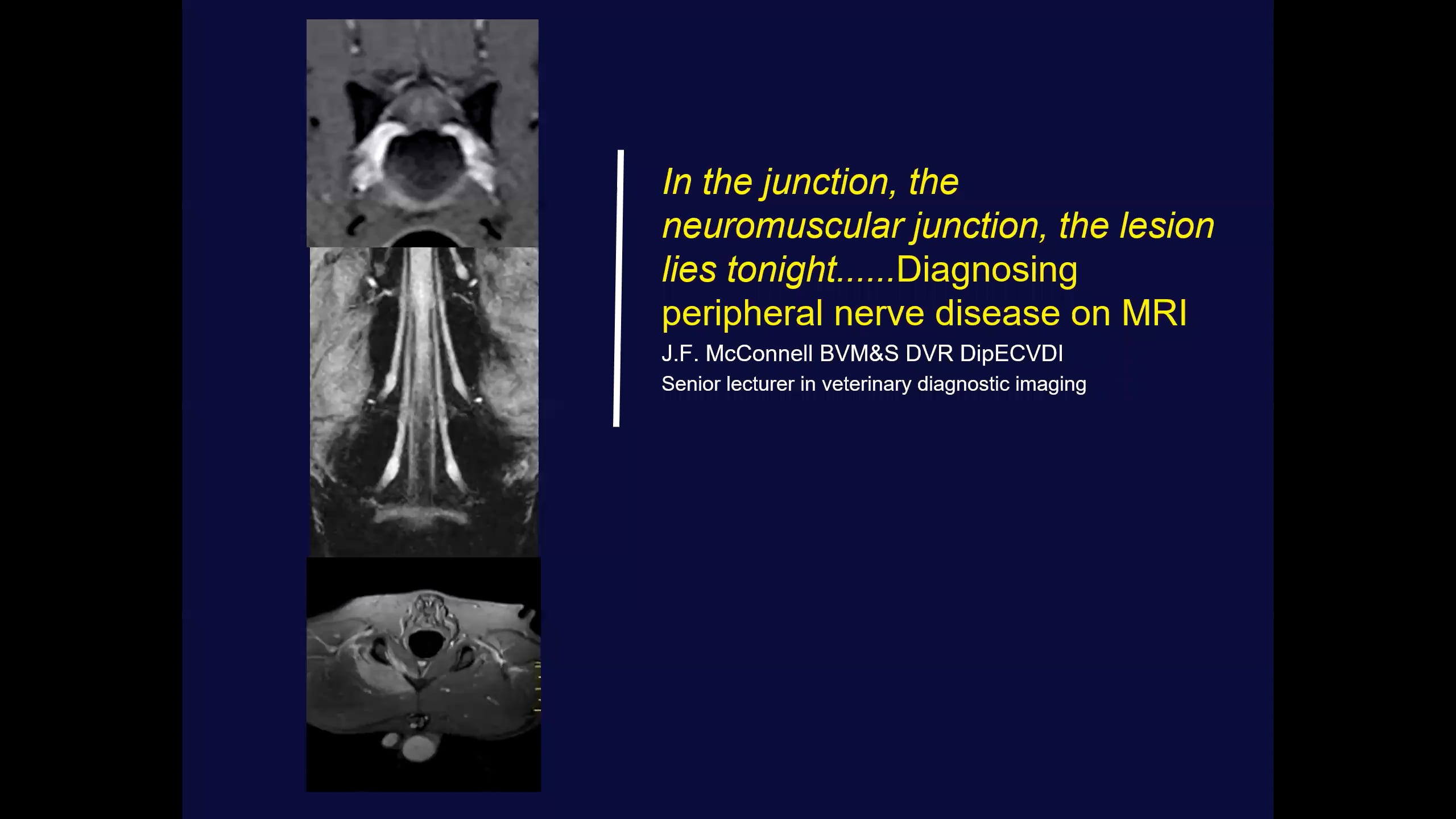 In the junction, the neuromuscular junction, the lesion lies tonight......Diagnosing peripheral nerve disease on MRI