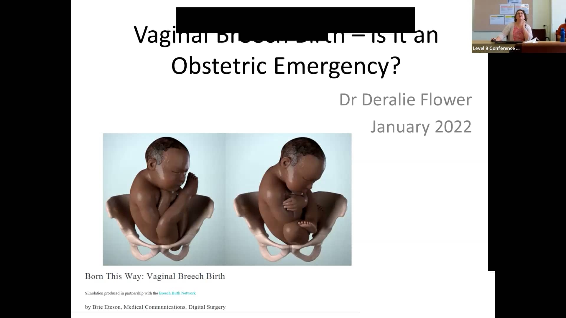 Breech Birth on Vimeo