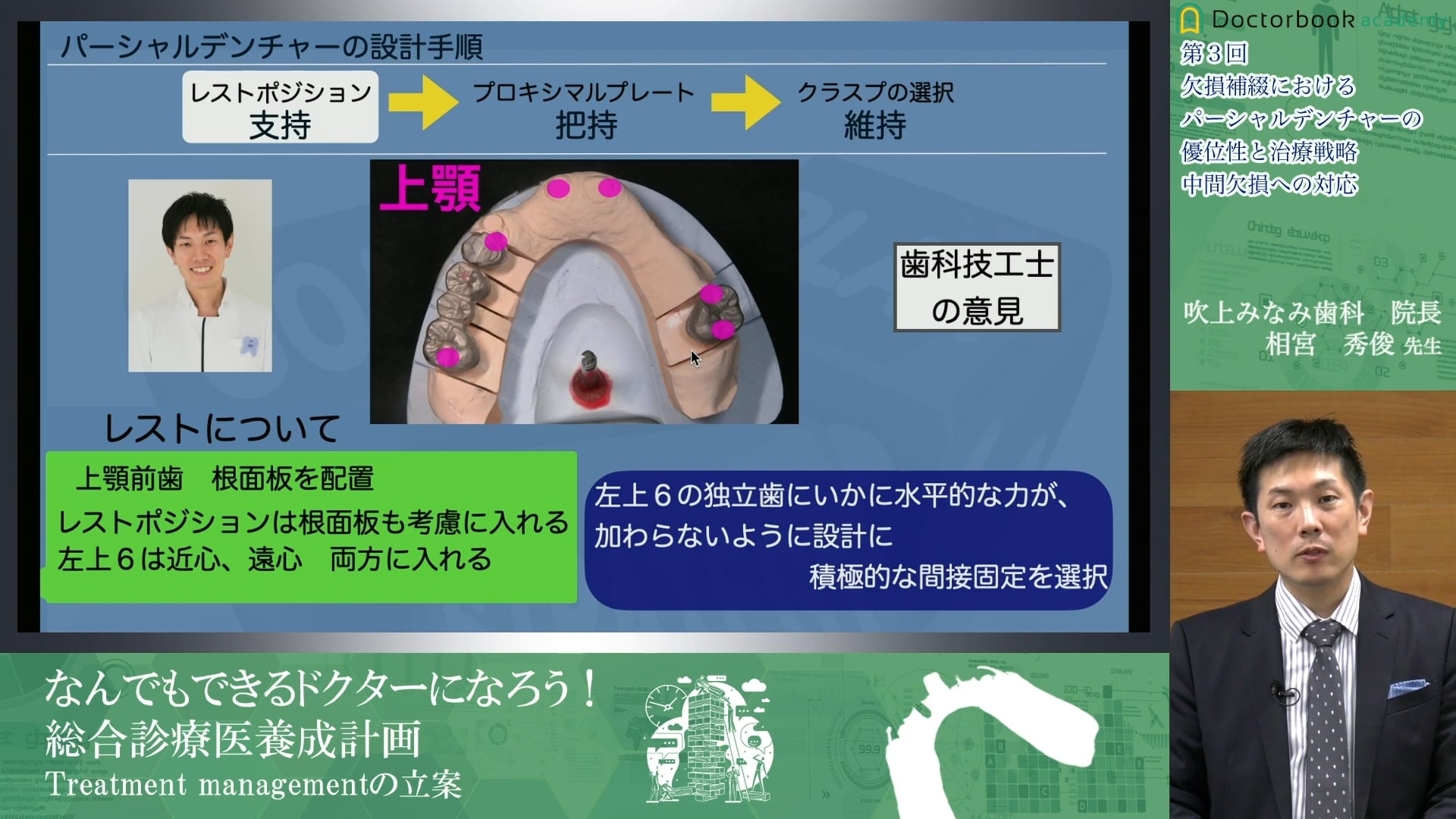 なんでもできるドクターになろう！ 総合診療医養成計画③　欠損補綴におけるパーシャルデンチャーの優位性と治療戦略　中間欠損編