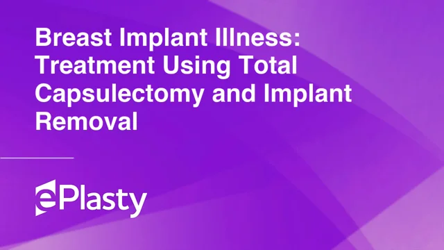 Breast Implant Illness: Treatment Using Total Capsulectomy and Implant  Removal