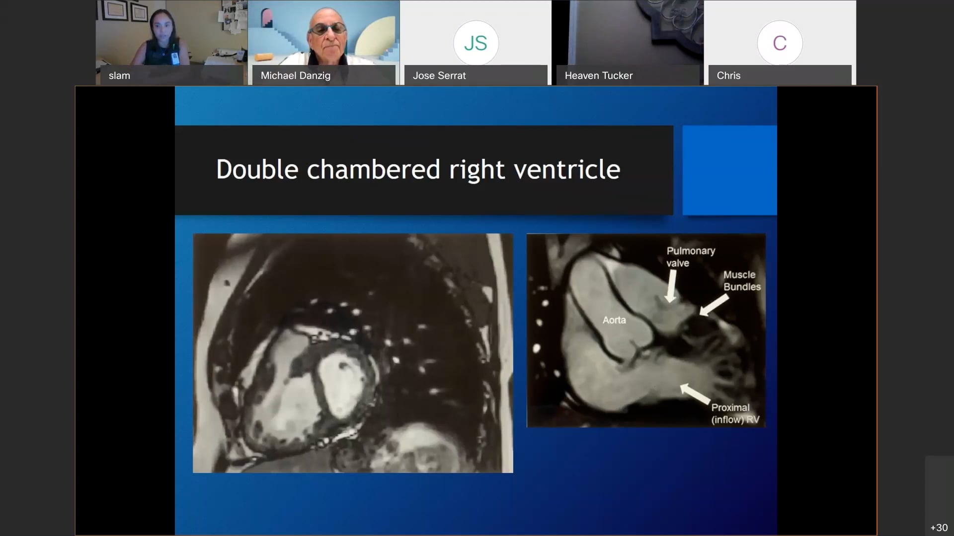 HVI Interesting Cases LPG Cardiology 2022 to 2025 on Vimeo