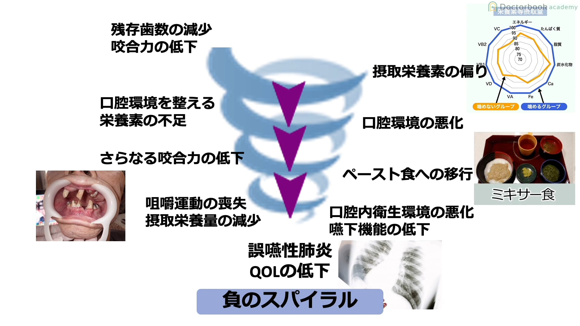 Part3 応用編 〜摂食嚥下障害患者への介入〜 1