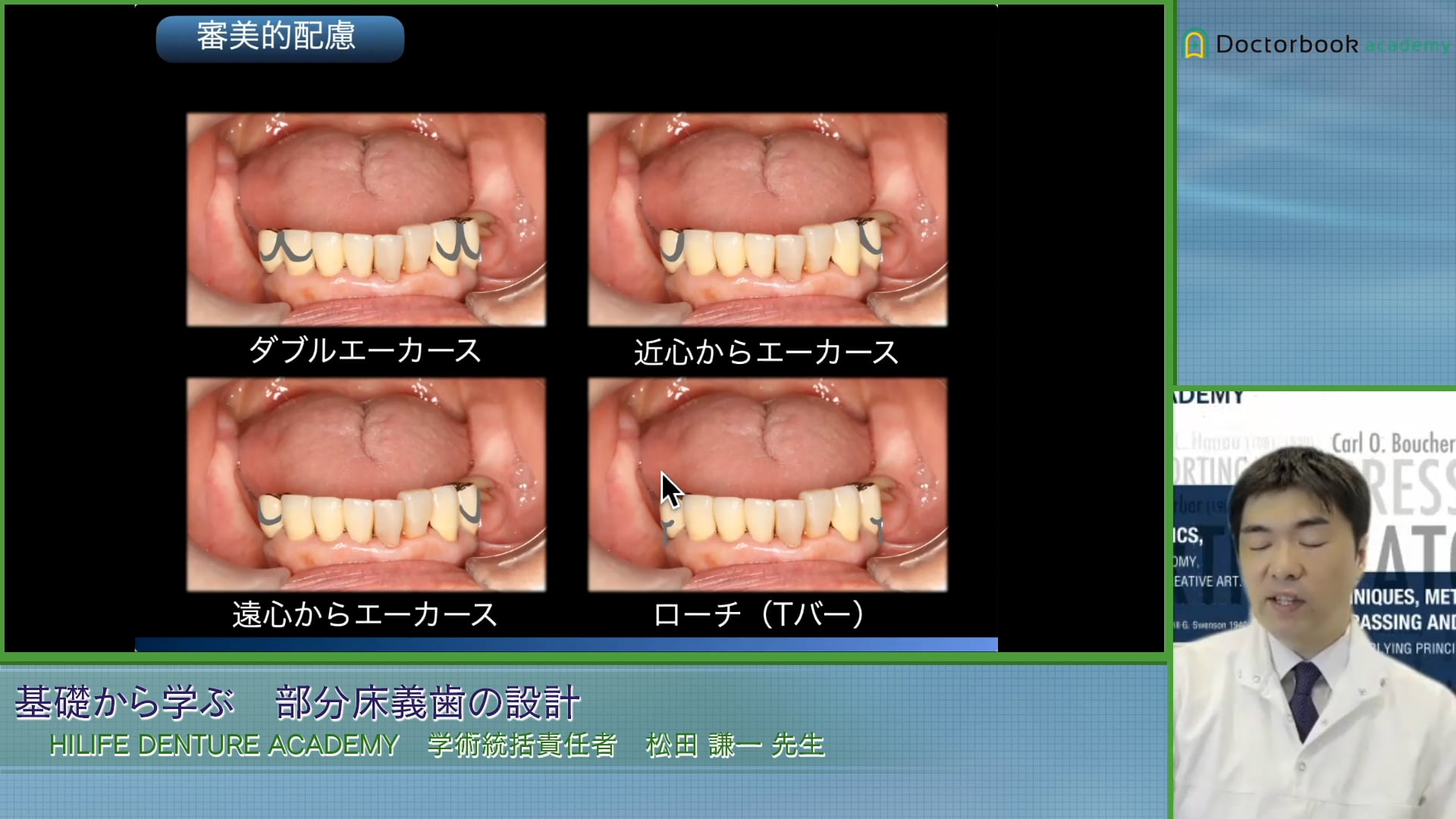 #3 設計に必要な把持・維持の考え方