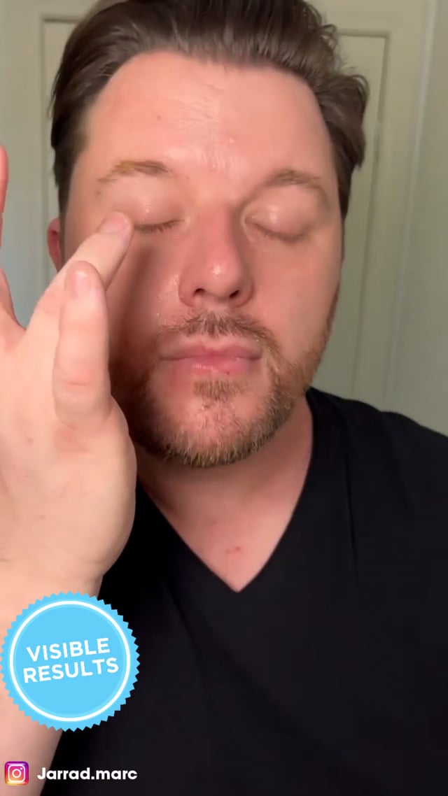 Face & Eyelid Eczema Cream