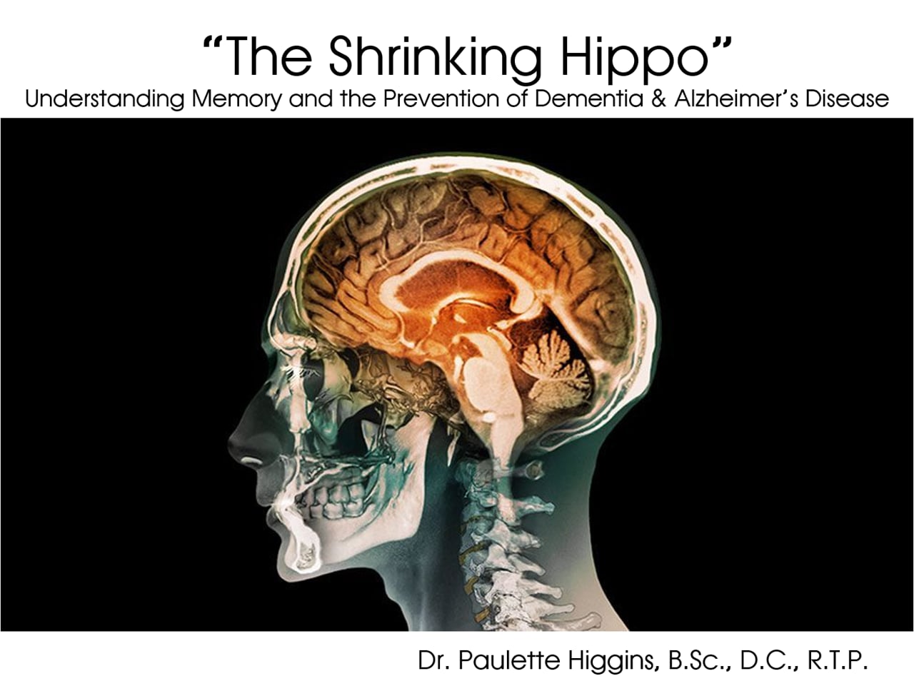 "The Shrinking Hippo" Webinar