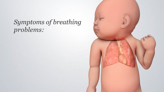 retractive breathing newborn