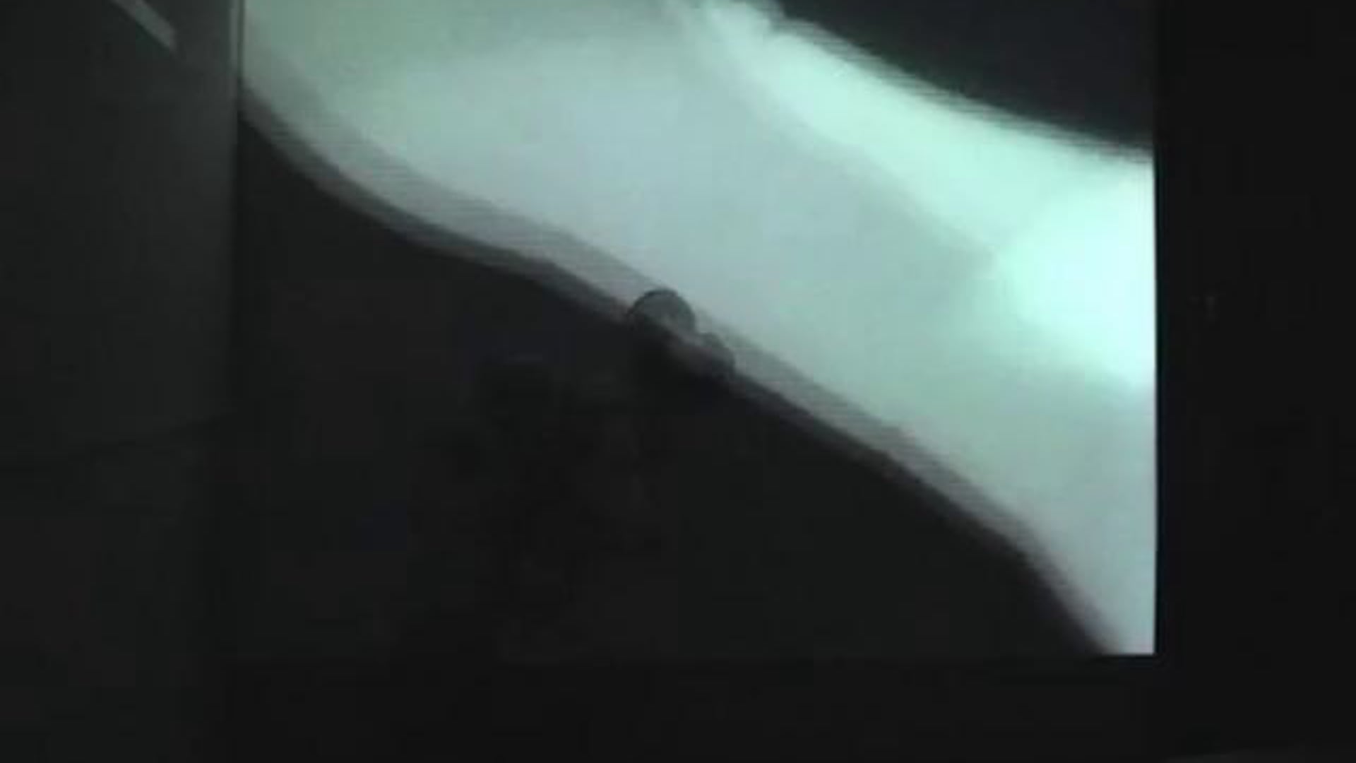 Simulation 4: Leopard Frog/ Balloons