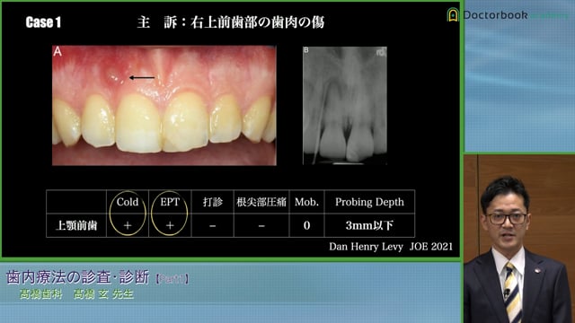 #1 歯内療法における治療法の決定・提示