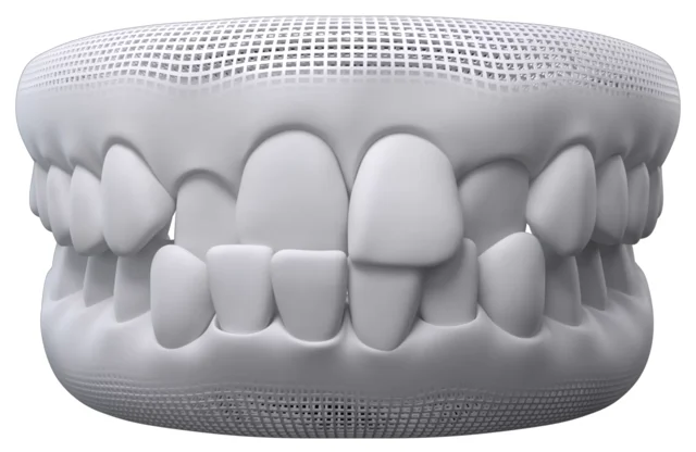 Trident Smiles Dental  Average Invisalign cost: How expensive is