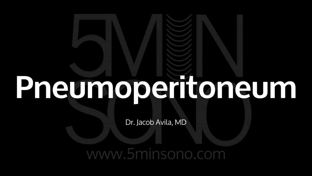 Image of Five Min Sono – Pneumoperitoneum