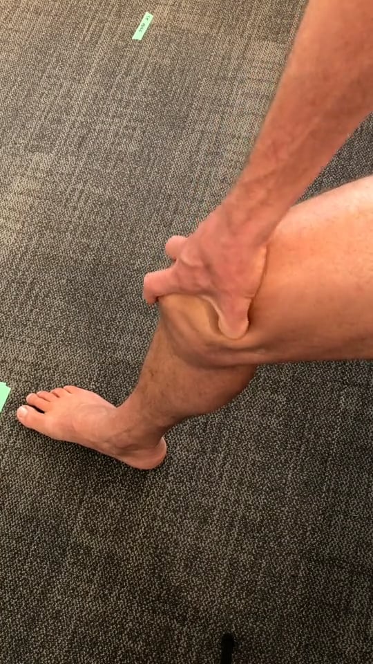 Medial thigh distal release