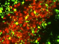 Newswise:Video Embedded uci-led-study-links-early-life-adversity-microglia-dysfunction-to-aberrant-adult-stress-responses-mental-illness